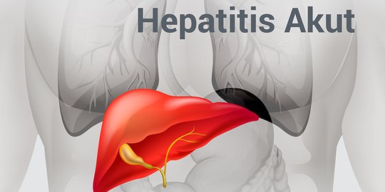 RSPI: Pasien Hepatitis Akut Terbuka Kemungkinan Transplantasi Hati