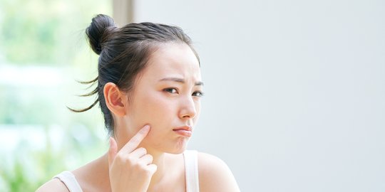 5 Perawatan Kulit yang Bisa Dilakukan untuk Mengatasi Bruntusan di Wajah