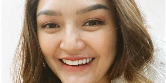 Jadi Ibu, Ini Potret Terbaru Siti Badriah Dipuji Cantik dan Makin Fresh