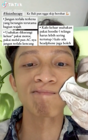 viral pria ini alami kelainan otot pada wajahnya ternyata ini penyebabnya