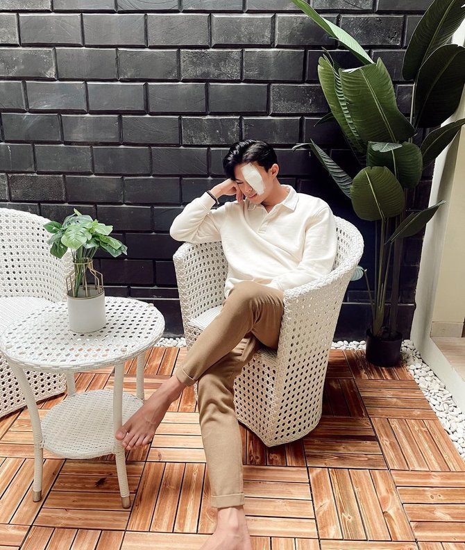 potret rey mbayang dengan mata diperban