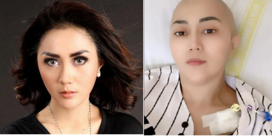 Idap Kanker Payudara dan Bipolar, Ini Curhatan Pilu Aida Saskia