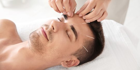 Mengenal Akupunktur Medik, Metode Terapi yang Kini Banyak Diminati