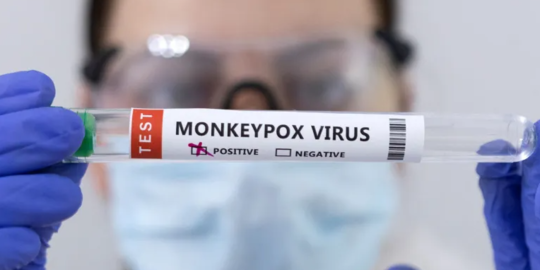 Hasil Penelitian: Virus Penyebab Cacar Monyet Bermutasi dan Mudah Menyebar