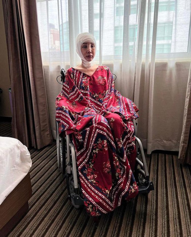 lucinta luna operasi potong leher