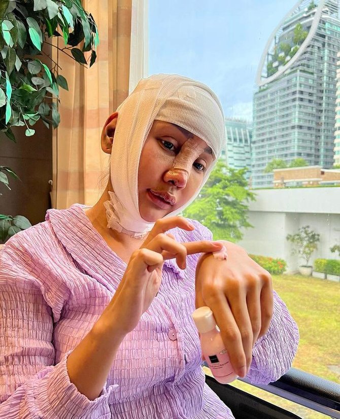 lucinta luna operasi potong leher