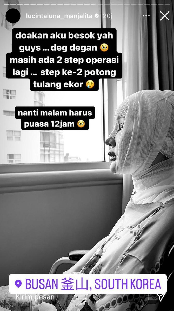 lucinta luna operasi potong leher