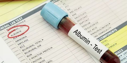 Albumin adalah Protein Utama dalam Darah Manusia, Ketahui Efeknya