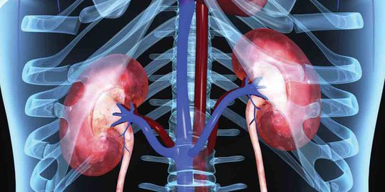 Mengenal Hidronefrosis Dan Penyebabnya, Bisa Sebabkan Ginjal Membengkak