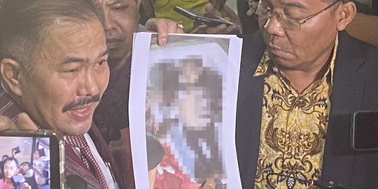 Kasus Brigadir J, Kapolri Disarankan Bentuk Tim SCI