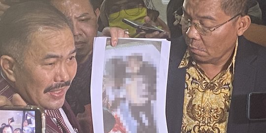 Kuasa Hukum Sebut Autopsi Brigadir J Diintervensi Orang Tertentu