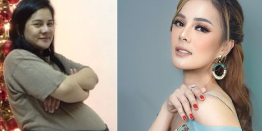 Transformasi Astrid Tiar yang Kini Jadi Sorotan, Makin Cantik dan Langsing