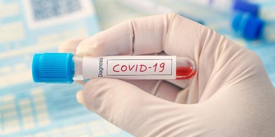 ASEAN Para Games XI, 10 Atlet Renang Positif Covid-19