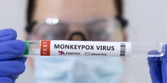 Kemenkes: Hasil Tes Sampel Pertama Suspek Cacar Monyet di Jateng Negatif