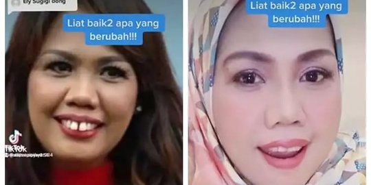 Deretan Foto Dulu dan Kini Elly Sugigi yang Bikin Pangling, Makin Cantik Dikira Oplas