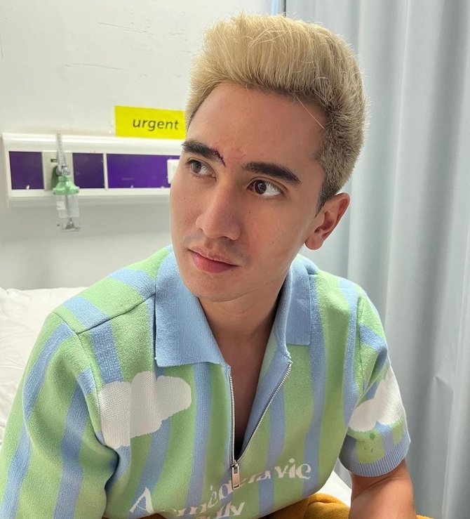 Verrell Bramasta Mendapat 20 Jahitan Di Alisnya Setelah Didorong Teman, Ini Fotonya