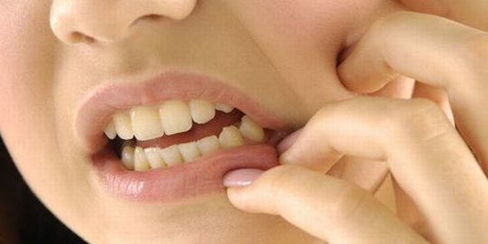 Ketahui Masalah Kesehatan yang Bisa Muncul Akibat Gigi Tidak Rapi