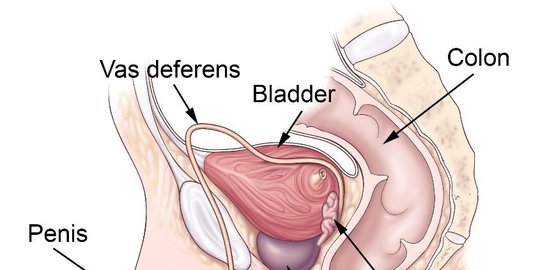 Mengenal Hidrokel, Penyakit pada Testis yang Jarang Disadari