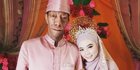 5 Potret Shasa Puspita Dewi, Istri Surya Manurung TikToker Pengidap Sindrom Langka
