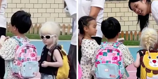 Anak Albino Menginspirasi Jutaan Orang di China