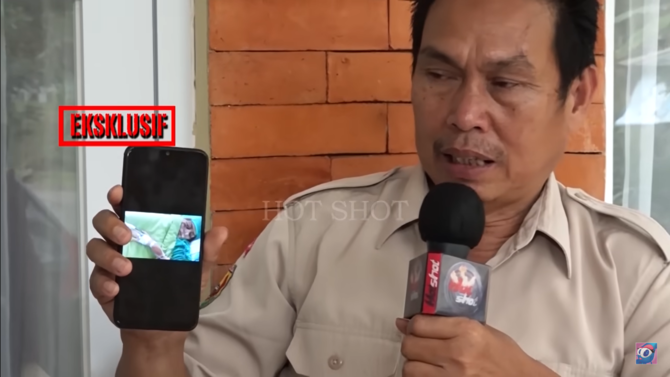 keluarga tunjukkan foto kondisi sang pedangdut
