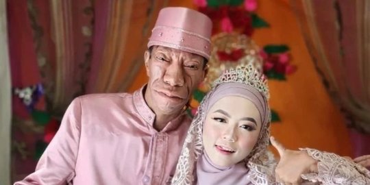 Akui Tembak Duluan, Ini Alasan Shasa Yakin Nikah dengan TikToker Surya Manurung