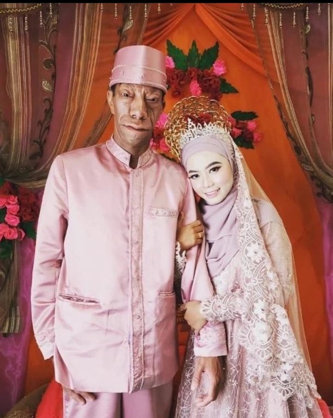 5 potret shasa istri surya manurung tiktoker pengidap sindrom langka