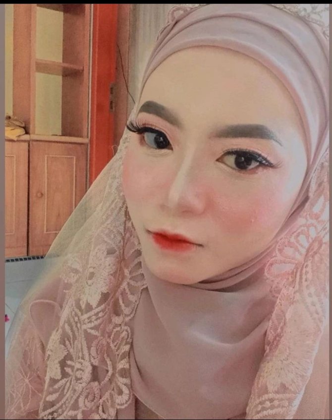 5 potret shasa istri surya manurung tiktoker pengidap sindrom langka