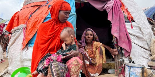 Potret Anak-Anak Somalia Menderita Gizi Buruk Akut