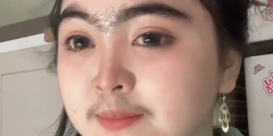 Jadi Sorotan dan Viral, Gadis Ini Miliki Alis Menyatu dan Kumis Lebat
