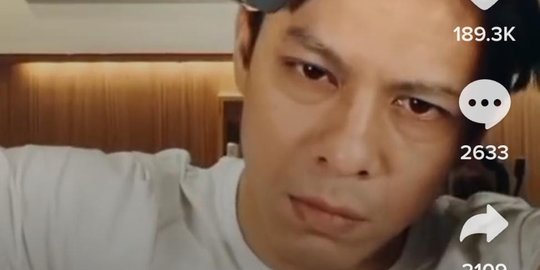 Wajah Ariel Noah Tiba-tiba jadi Seram, Netizen 'Tetap Masih Ganteng'