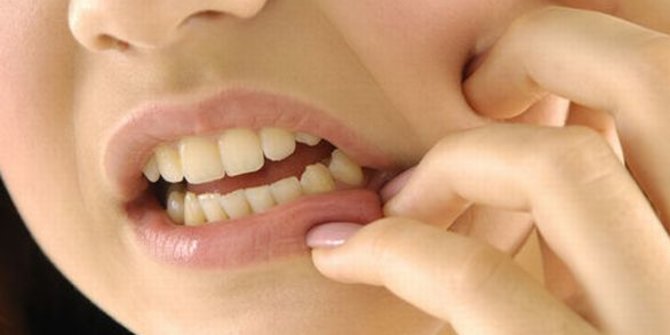 Mempertahankan Gigi Jadi Cara yang Lebih Dipilih Dibanding Mencabutnya
