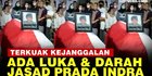 VIDEO: Kejanggalan Kematian Prada Indra Dianiaya 4 Prajurit TNI AU, Ada Luka Sayatan