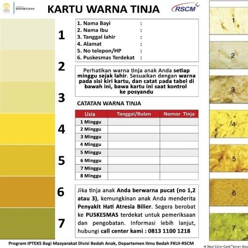 kenali sedari dini ini gejala kuning pada bayi yang dianggap berbahaya