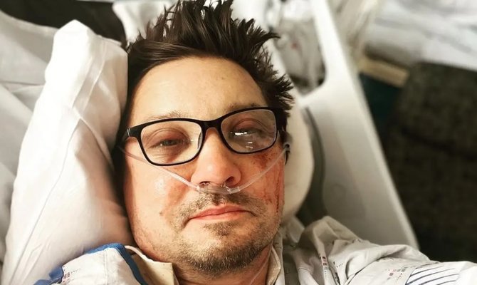 jeremy renner kecelakaan ini kondisi terkininya sapa warga hidung dipasang selang