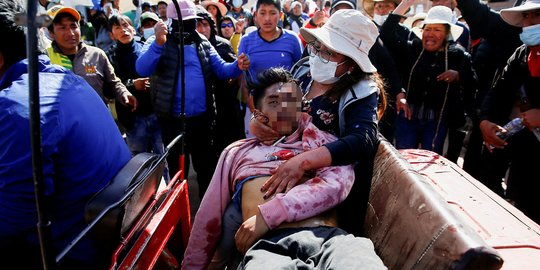 Bentrok Mematikan Polisi vs Pengunjuk Rasa di Bandara Peru, 17 Tewas