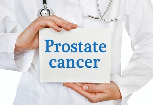 ilustrasi kanker prostat