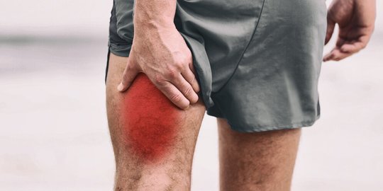 Cara Mengatasi Cedera Hamstring, Mudah dengan Metode R.I.C.E.
