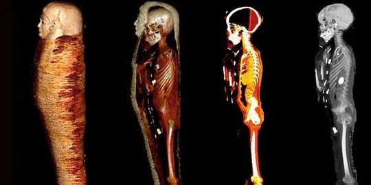 Mumi Bocah Mesir Dikubur dengan Jantung Kedua Terbuat dari Emas, Ini Tujuannya