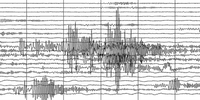 Analisis BMKG Penyebab Gempa Magnitudo 5,2 di Banten