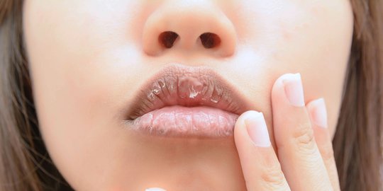 Bibir Kering dan Pecah-Pecah? Begini Rangkaian Perawatan yang Bisa Dilakukan