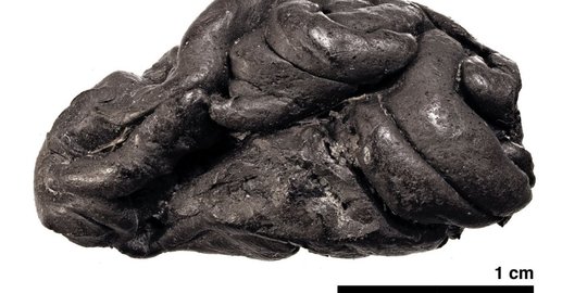 Permen Karet Zaman Batu Berusia 5.700 Tahun Ungkap Sosok Manusia Pengunyahnya