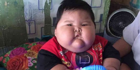 Bayi 16 Bulan di Bekasi Memiliki Berat Badan 26 Kg, Orang Tua Sulit Menggendong