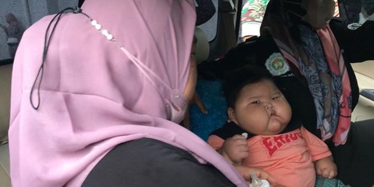 Bayi Obesitas di Bekasi Dirujuk ke RSCM untuk Penanganan Lebih Lanjut