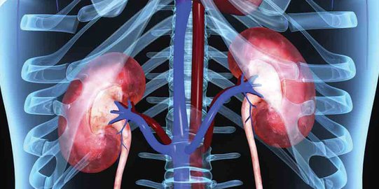 Mengenal Uremia dan Penyebabnya, Kondisi Penumpukan Urea dalam Darah