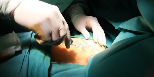 Transplantasi Ginjal Pertama Sukses Dilakukan pada 4 Maret 1954, Bertahan 8 Tahun