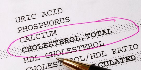 Cara Mengatasi dan Mencegah Kadar Kolesterol Terlalu Rendah pada Seseorang