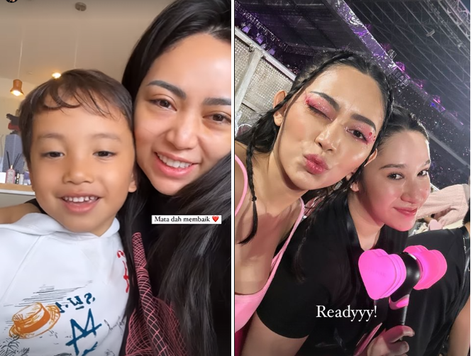 potret terbaru rachel vennya pasca sedot lemak matanya jadi sorotan