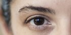 Gejala Retinoblastoma yang Mudah Dikenali, Gangguan Mata Akibat Faktor Genetik