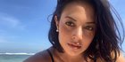 Aurelie Moeremans Idap Tumor Colli, Usai Suntik Wajah Seperti Lumpuh
